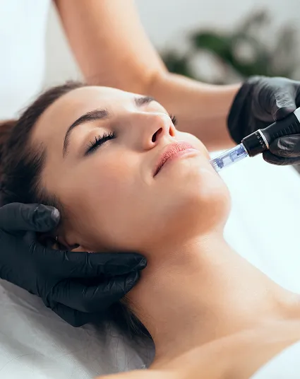 Microneedling w/ stem cells
